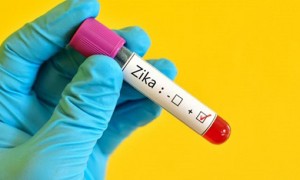 Brasil investigará outras consequências do zika em crianças