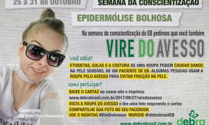 Campanha abre espaço para compreensão sobre doença rara que causa bolhas na pele